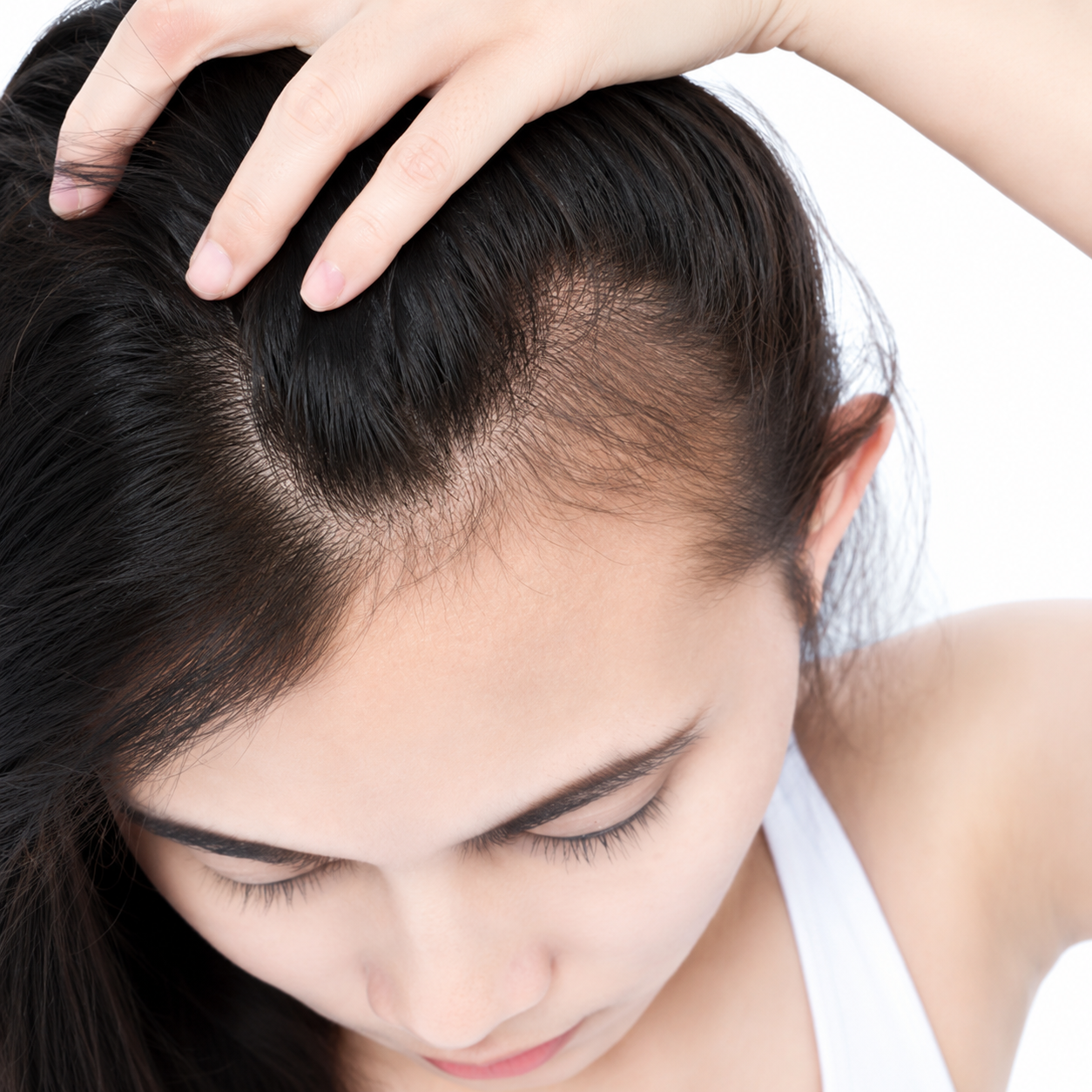 Female Hair Loss Treatment 