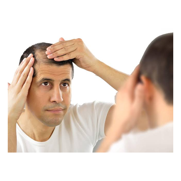 Male Hair Loss Treatment  
