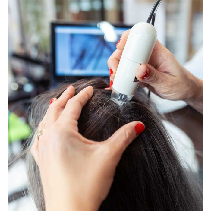 Scalp Treatment for Hair Fall  